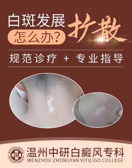 溫州白癜風醫院那家好